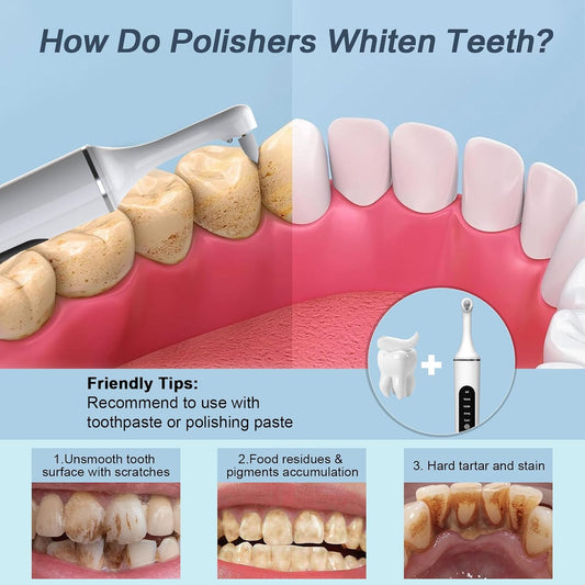 Tooth Polisher,Rechargeable Tooth Whitening Kit for Teeth Cleaning and Whitening