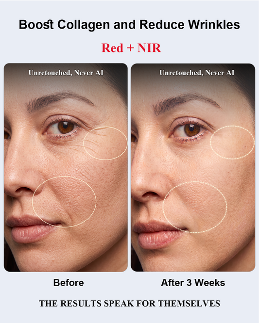 Red Light Therapy for Face,Red Light Therapy,All-New2026Model