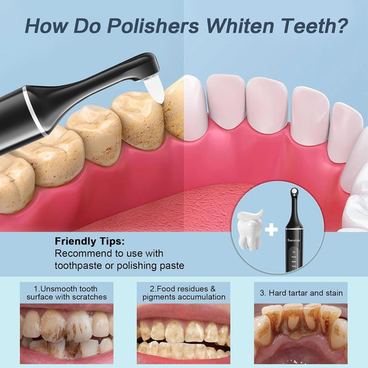 Tooth Polisher,Rechargeable Tooth Whitening Kit for Teeth Cleaning and Whitening