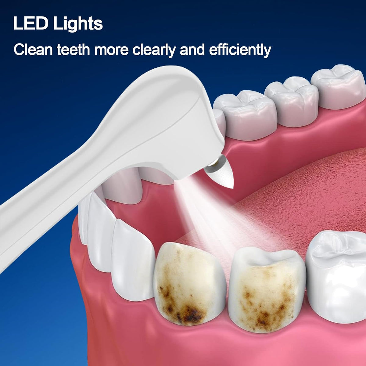 Tooth Polisher,Rechargeable Tooth Whitening Kit for Teeth Cleaning and Whitening