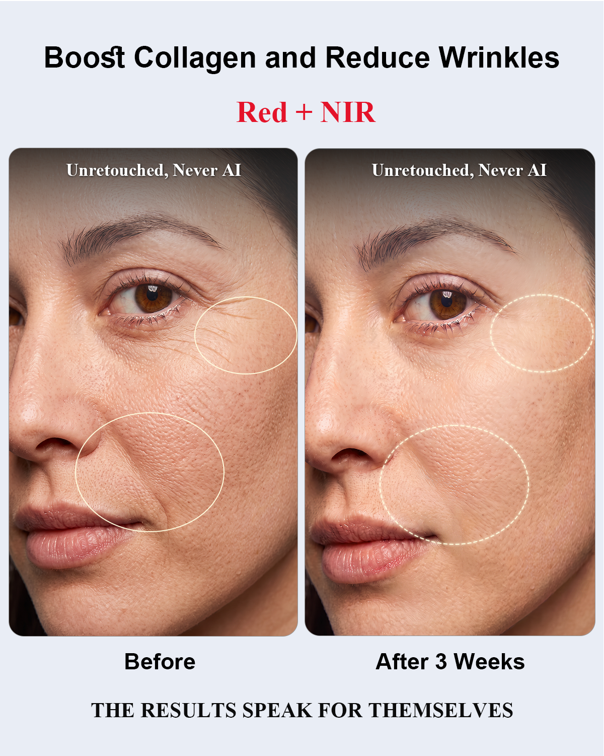 Red Light Therapy for Face,Red Light Therapy,All-New2026Model