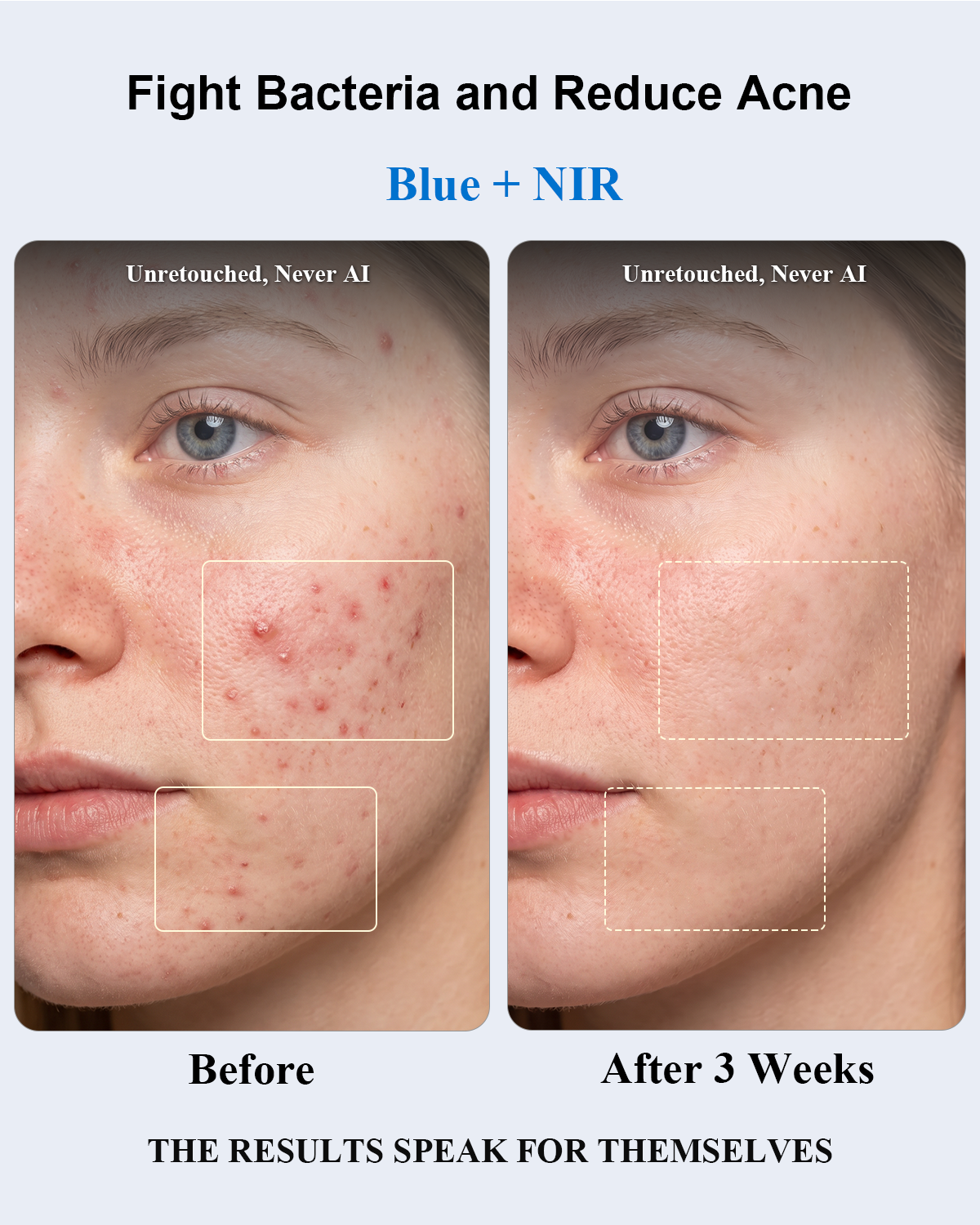 Red Light Therapy for Face,Red Light Therapy,All-New2026Model