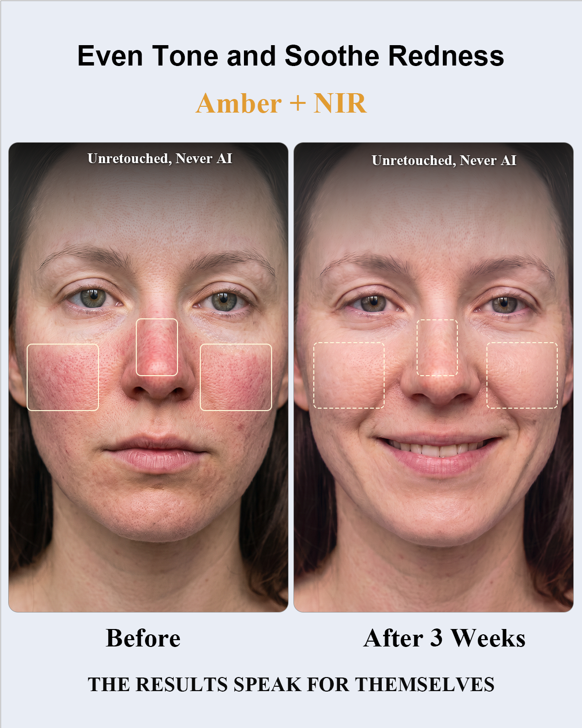 Red Light Therapy for Face,Red Light Therapy,All-New2026Model